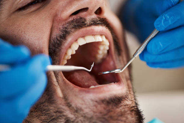Best Cracked Tooth Emergency Dentist  in Mullica Hill, NJ