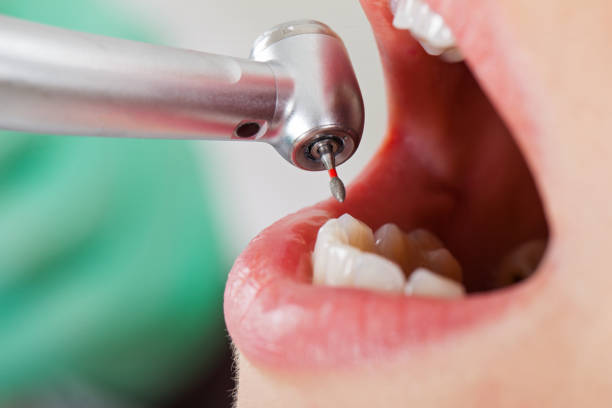 Best Dentist for Tooth Abscess  in Mullica Hill, NJ